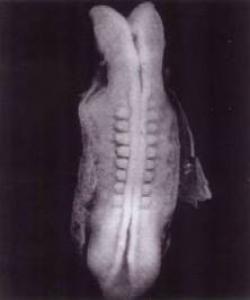 (العلقە) كە بە منداڵدانەوە هەڵواسراوە..له قورئانهوه