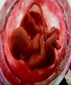 کەمترین ماوەی سکپڕی شەش مانگە .. له قورئاندا