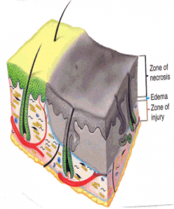 ئێش ههموو له پێستدایه سهلماندنی ئهم راستیه له لایهن زانستی تازهی پزیشكی یهوه :