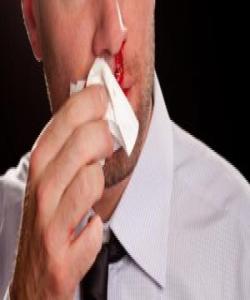 ئهو سهرپێچیانهى دهستنوێژ پوچهڵ دهکهنهوه : (٤) دهرچوونى خوێن: