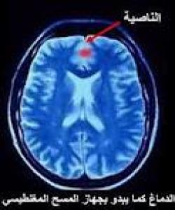 ئیعجازى زانستى لهسهر شوینى درۆکردن ( الناصیه ) له قورئاندا