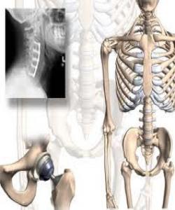 ئێسک کارگهى بهرههمهێنانى خوێنه